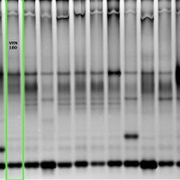 VEN180 gel