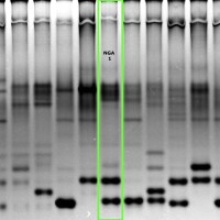 NGA1 gel