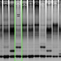 VEN168 gel