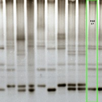 PAR17 gel